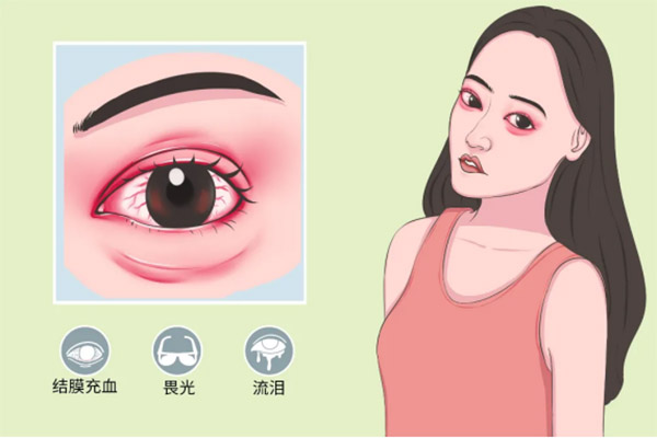 次氯酸治疗细菌性和病毒性结膜炎 次氯酸治疗细菌性和病毒性结膜炎