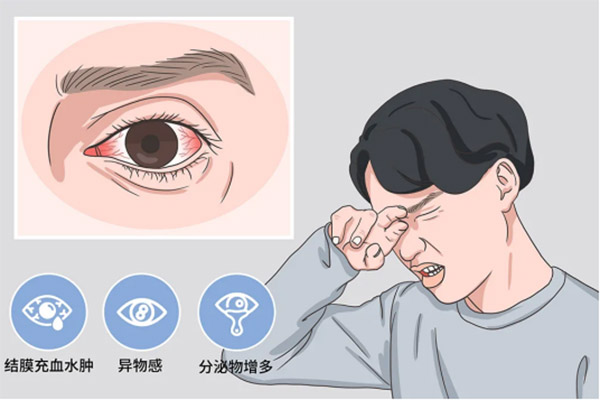 次氯酸治疗细菌性和病毒性结膜炎 次氯酸治疗细菌性和病毒性结膜炎