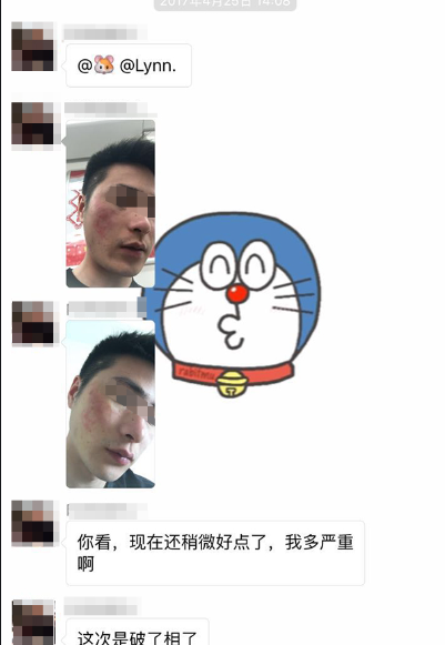 特应性皮炎苦不堪言 特应性皮炎苦不堪言