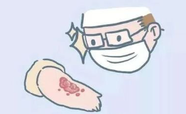 盛怀次氯酸水可治疗慢性伤口 盛怀次氯酸水可治疗慢性伤口