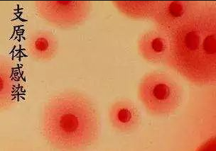 支原体感染图片 支原体感染图片